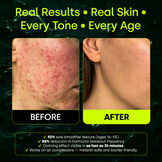 HYSKIN+ Solution Spray