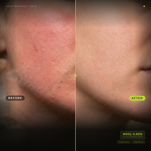 HYSKIN+ SOLUTION SPRAY
